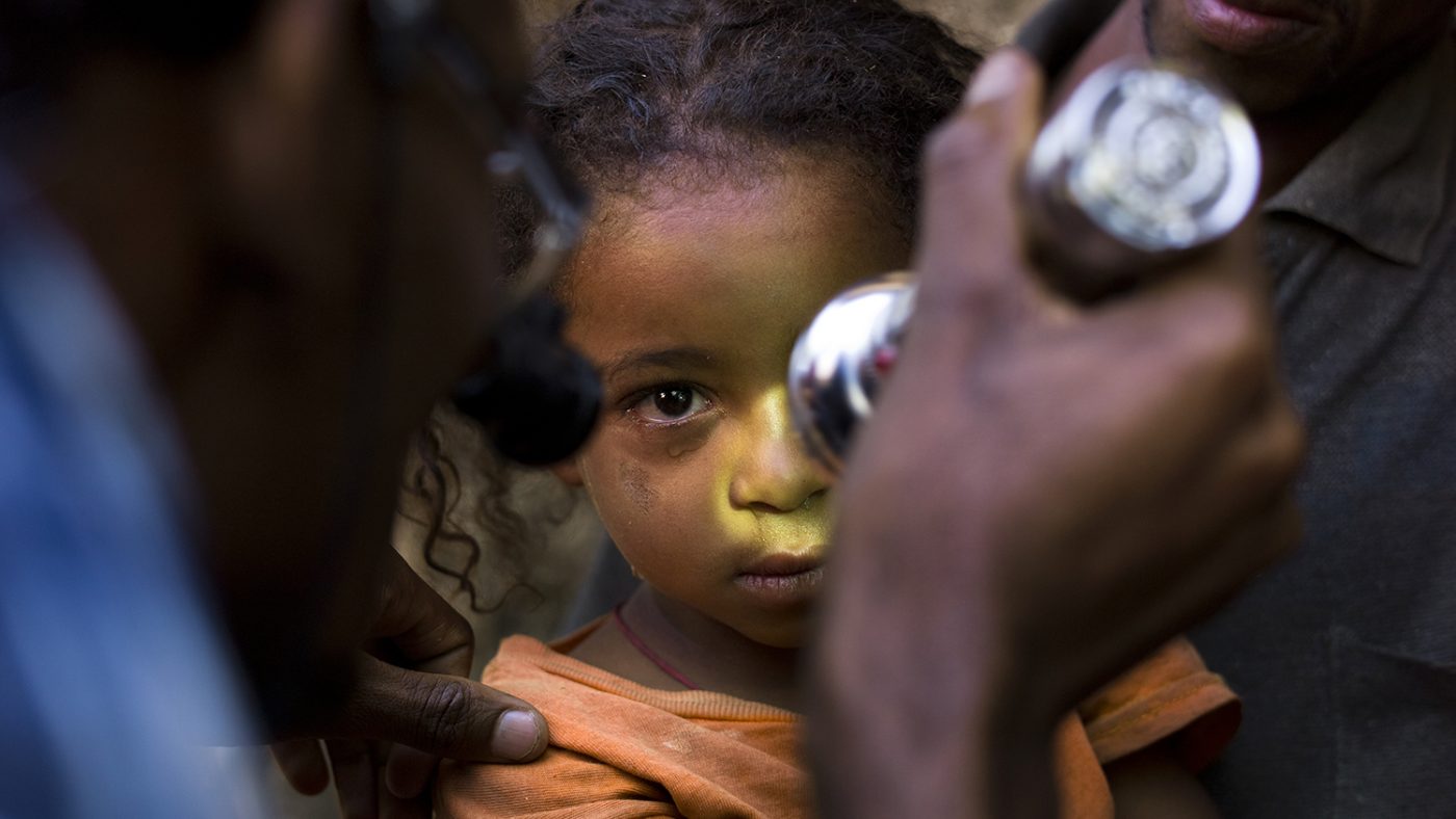 Eye Operations Campaign in Ghana - مخيمات العيون في غانا
