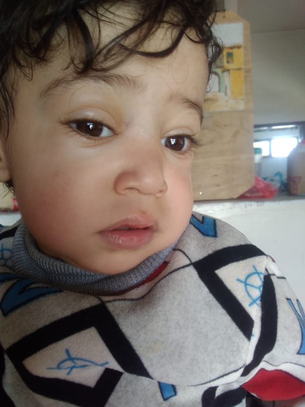 Urgent surgical intervention needed for the child Rakan