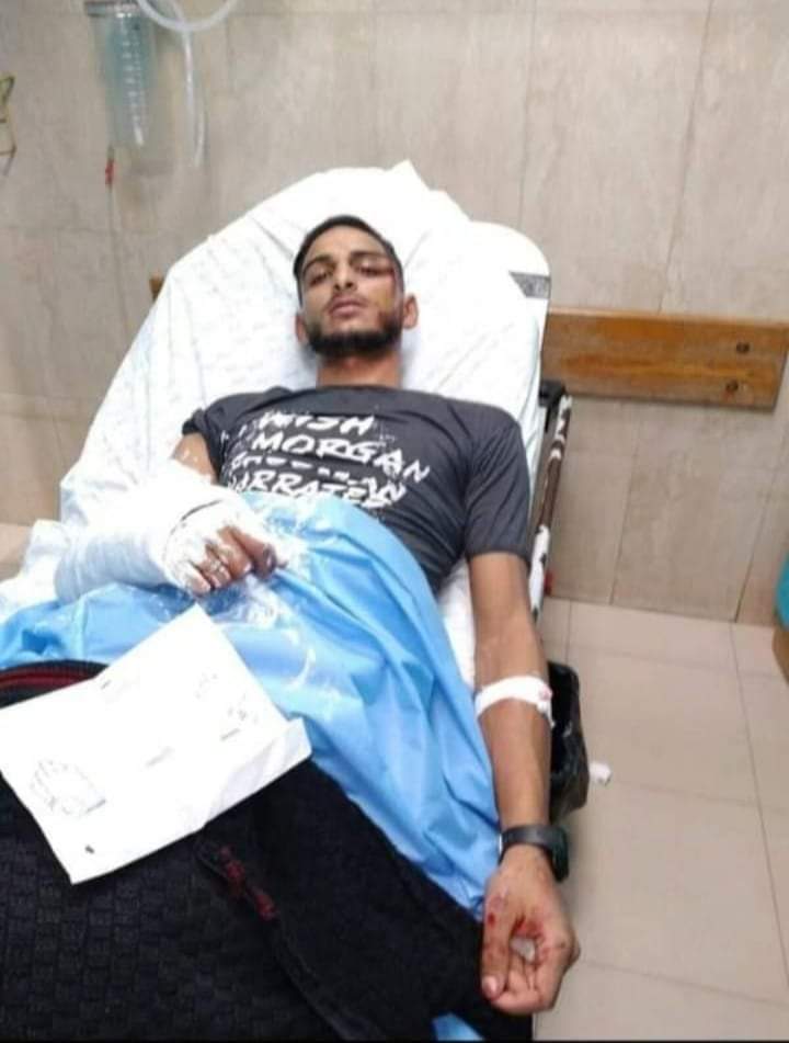 Urgent appeal for gunshot injured boy