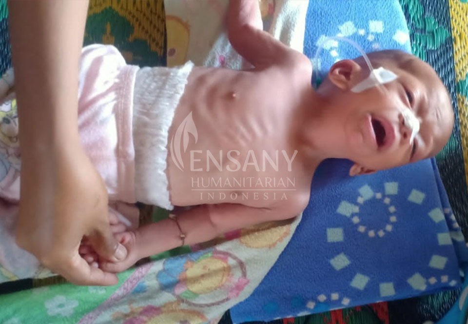 طلب مساعدة للأطفال المصابين بأمراض القلب  جنوب كاليمانتان - إندونيسيا