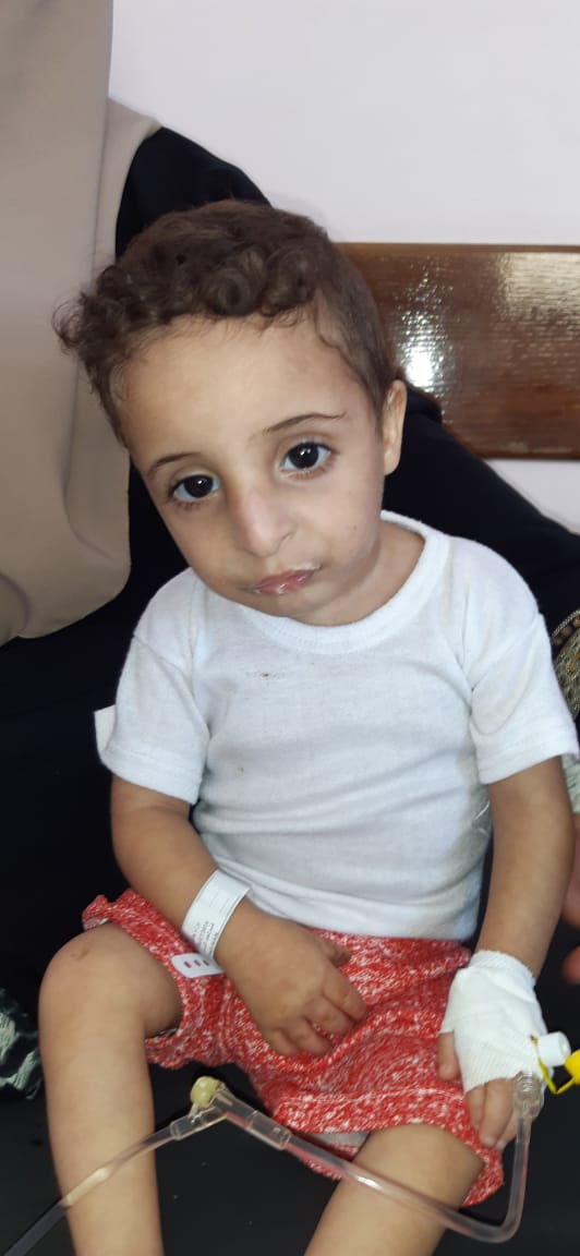طفل يحتاج لعلاج نقص المناعة