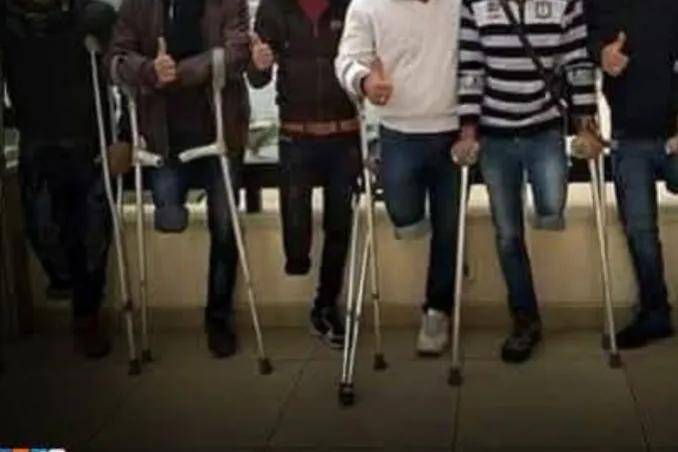 جريح من غزة مبثور القدم