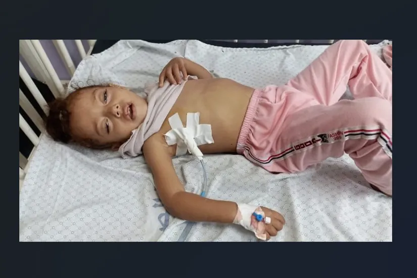 ساعد طفلة مصابة في غزة