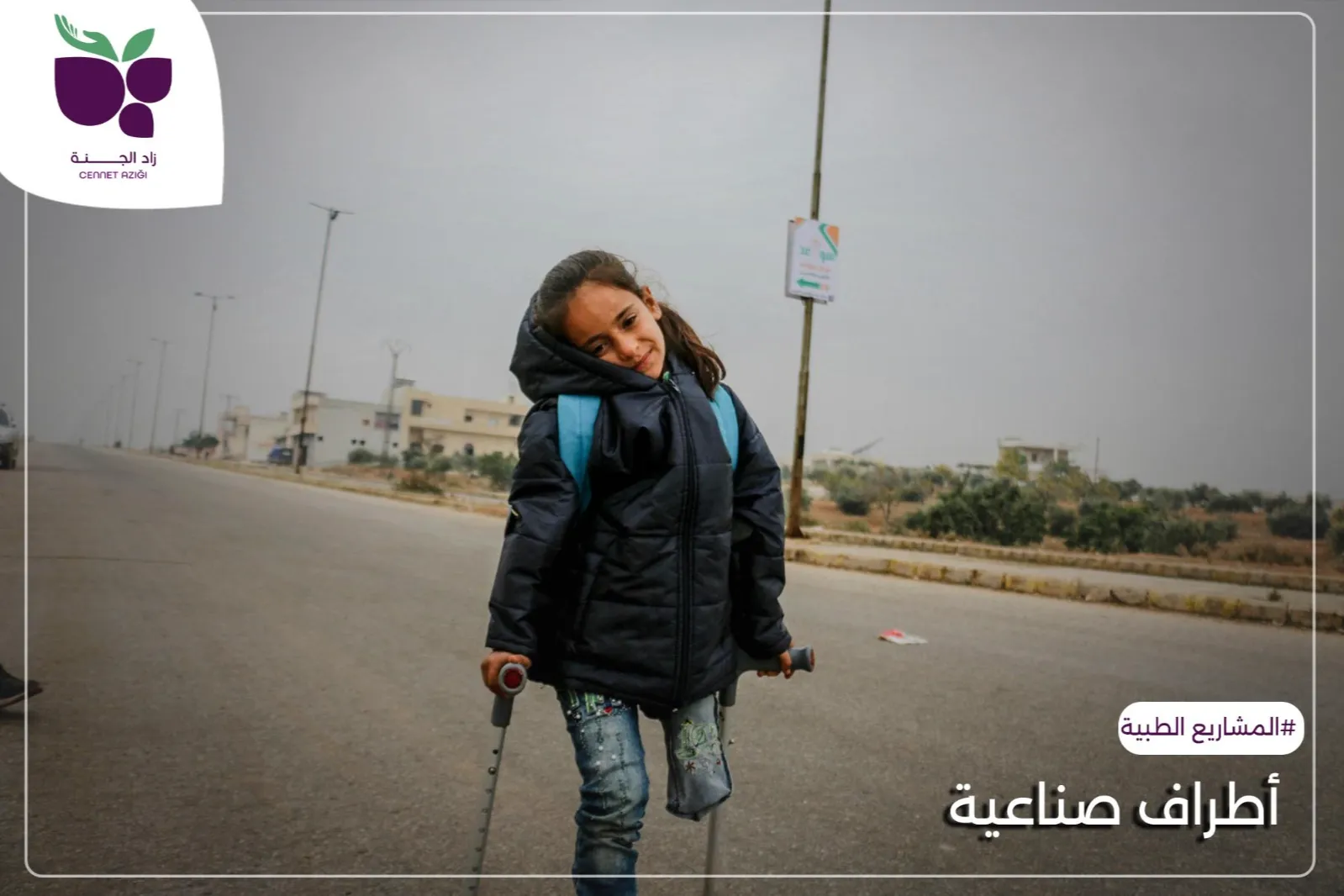 أطراف صناعية