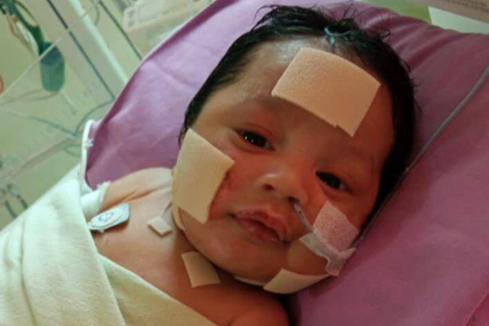 الإغاثة والأمل: تحسين الحياة مع انحلال البشرة الفقاعي (EB)