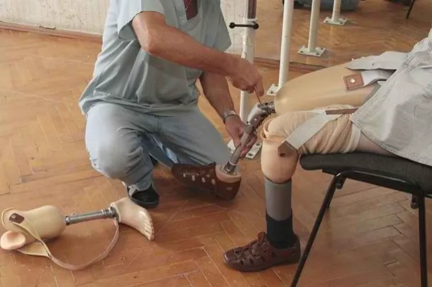 برنامج الأطراف الاصطناعية لمساعدة المحتاجين  ساعدهم على المشي من جديد والعيش باستقلالية أكبر