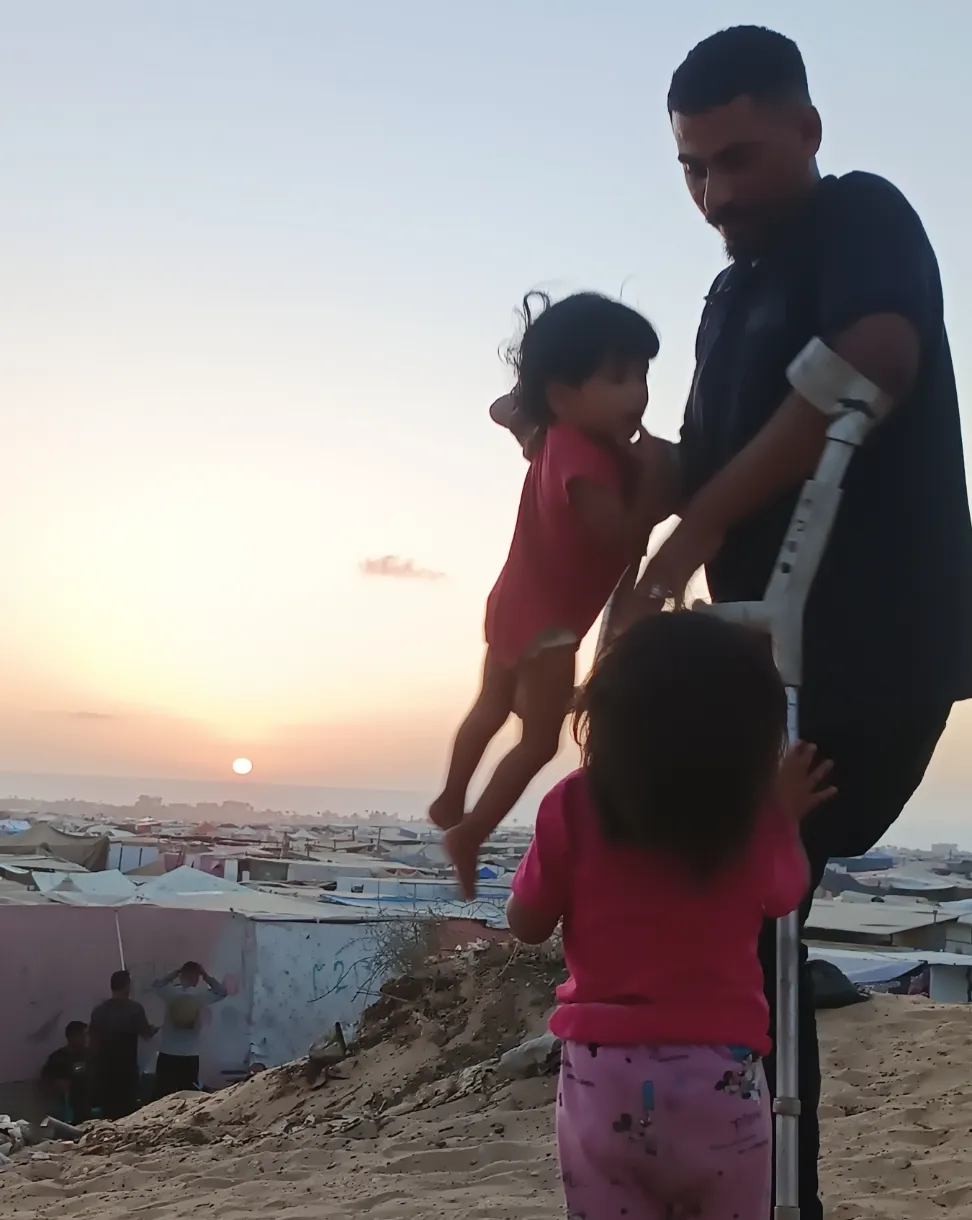 جريح مبثور القدم من غزة